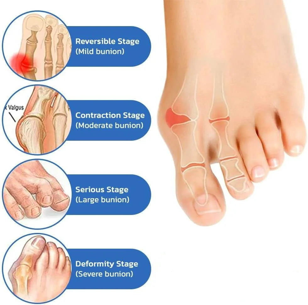 Calcetines antijuanetes y para la salud de las venas para mujeres y hombres