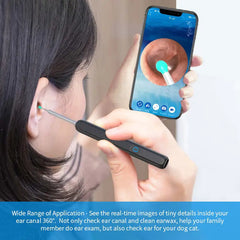 Towers E-comm™ LED Ear Cleaning Kit