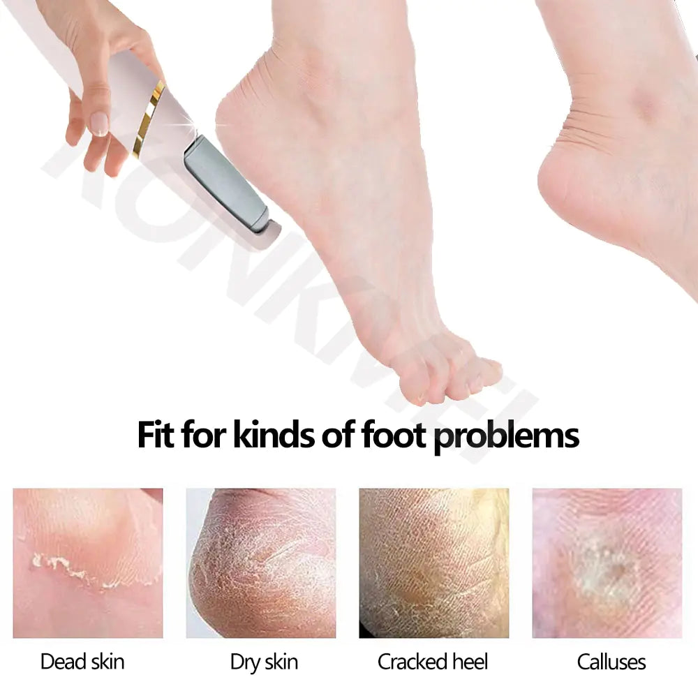 Kit eléctrico para el cuidado de los pies