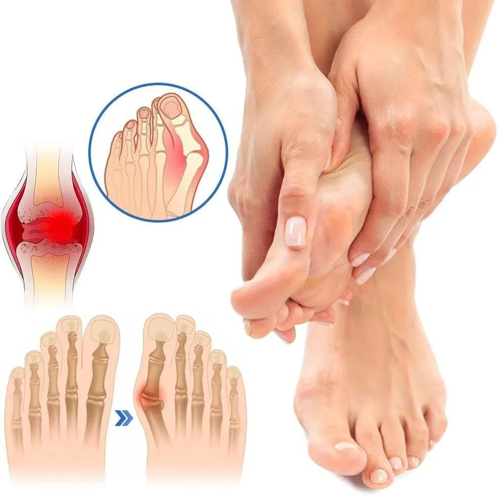 Calcetines antijuanetes y para la salud de las venas para mujeres y hombres