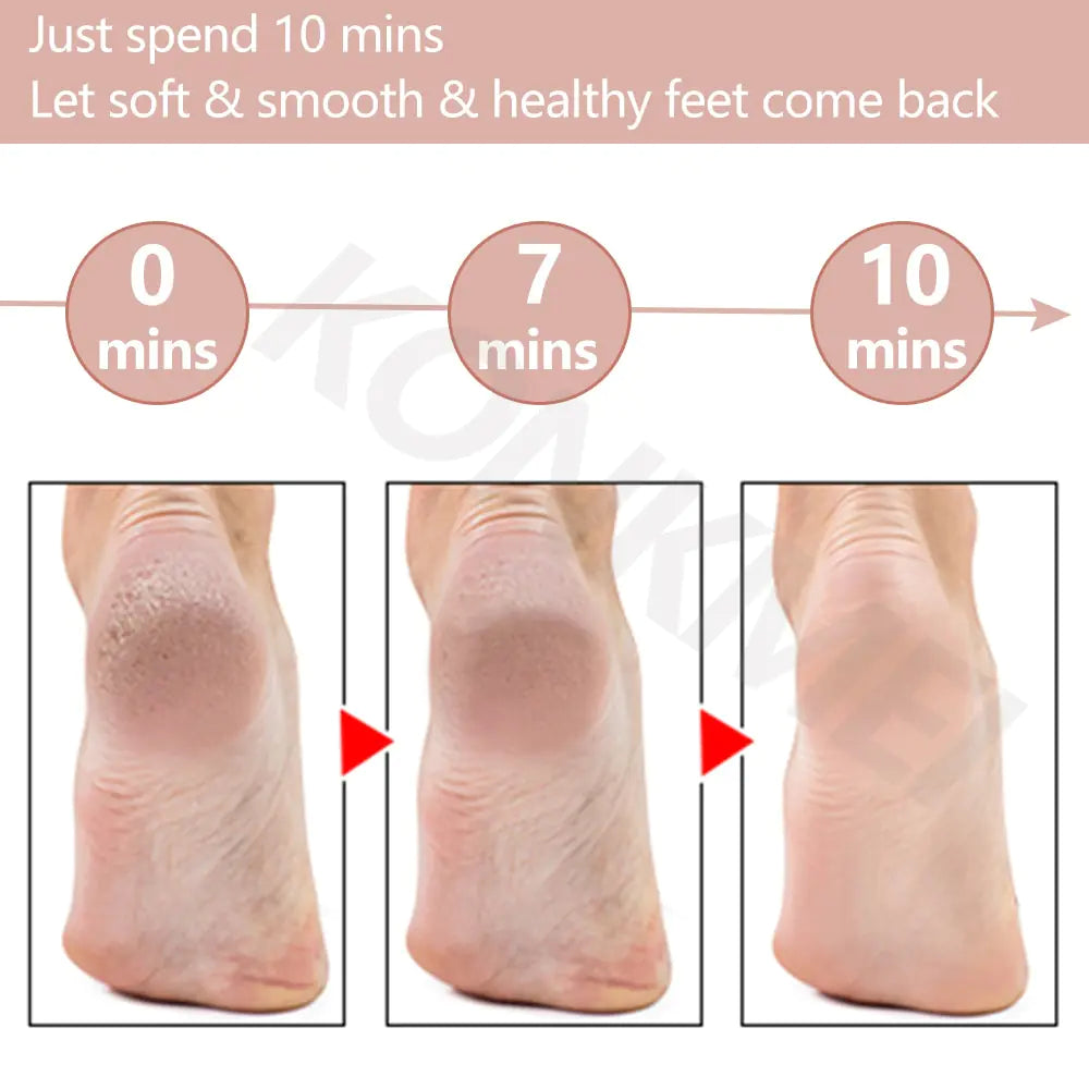 Kit eléctrico para el cuidado de los pies