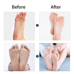 Electric Feet Callus Remover